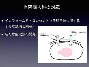図4．腫瘤を飛散させずに子宮筋腫を細切除去する方法を開発しています